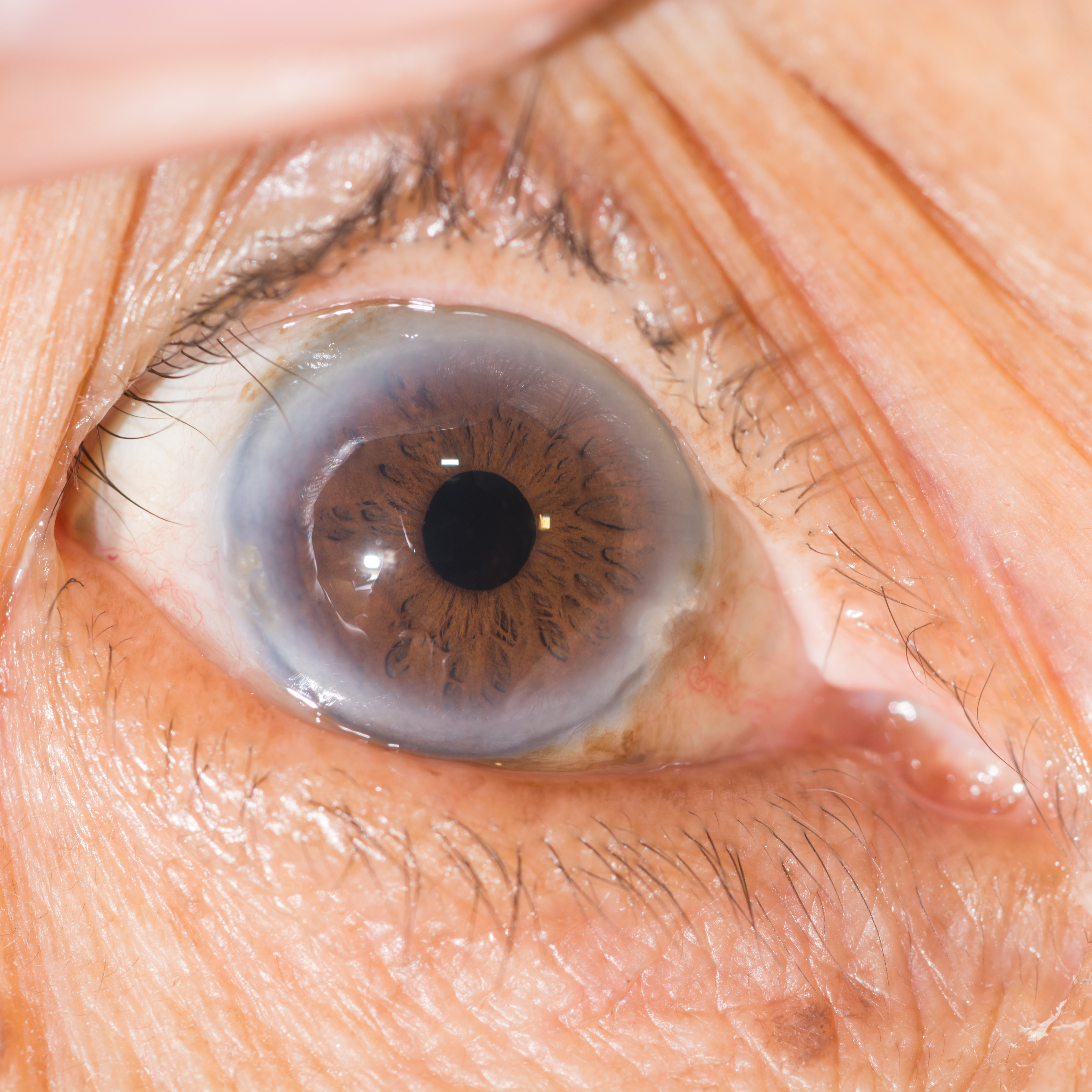 Maladie des yeux : le guide complet pour tout savoir